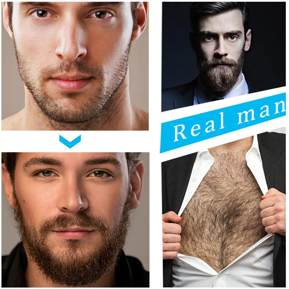 Ultimate Beard Care Growth Set